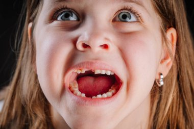 Mavi gözlü, dişleri dökülmüş, ağzı açık heyecanlı bir şekilde yukarı bakan genç bir kızın yakın çekimi. Etkileyici ve neşeli çocukluk anı.