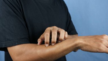 Mavi arka planda elini kaşıyan Asyalı genç adam. Uyuz, mantar enfeksiyonu, egzama, sedef, kızarıklık, alerji gibi kaşındırıcı deri hastalıkları kavramı..