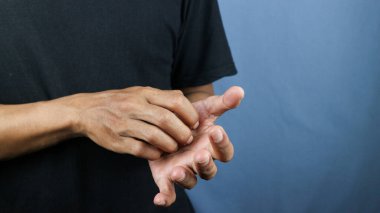 Mavi arka planda elini kaşıyan Asyalı genç adam. Uyuz, mantar enfeksiyonu, egzama, sedef, kızarıklık, alerji gibi kaşındırıcı deri hastalıkları kavramı..