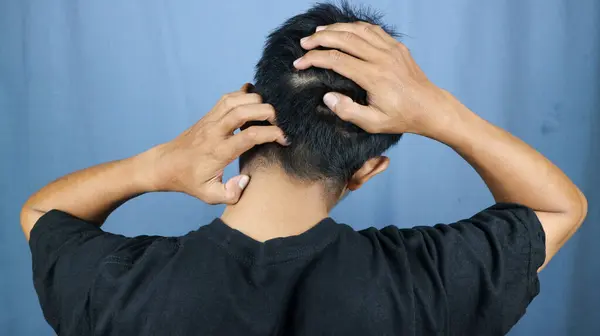 back view of a man scratching his head because it itches. dandruff problem concept