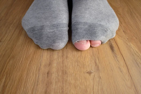 Wearing worn out socks with a hole and visible finger and toe sticking out. Poverty due to inflation. Legs on wooden floor. Close up photo.