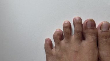 Uzun kesilmiş ayak tırnakları ve temiz beyaz arka plan yüzeyine yerleştirilmiş pürüzsüz deri dokusuyla insan ayaklarının yakın çekimi.