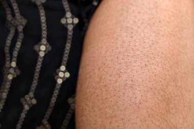 Bir insanın bacağının yumuşak dokusu rahat bir ortamda doğal saç büyümesini gösterir.