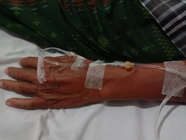 Hastanın eline serum yoluyla ilaç veren bir hemşire..