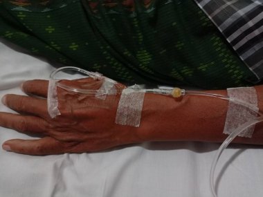 Hastanın eline serum yoluyla ilaç veren bir hemşire..