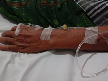 Hastanın eline serum yoluyla ilaç veren bir hemşire..