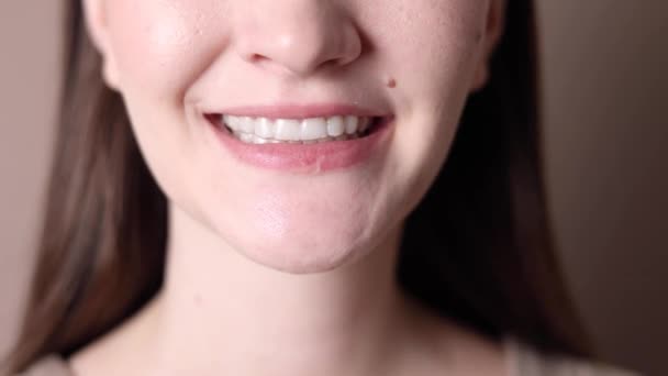 若い女の子は歯を矯正するためにアライナーを使用しています 高品質4K映像 — ストック動画