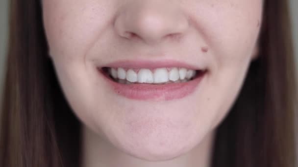 Ein Junges Mädchen Benutzt Aligner Ihre Zähne Richten Hochwertiges Filmmaterial — Stockvideo