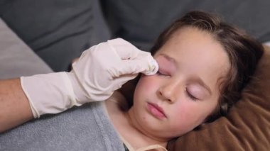 Göz kapağında şişmeye, kızarıklığa, ısıya ve kaşıntıya neden olan böcek, sivrisinek ya da arı ısırıklarının yol açtığı küçük bir çocukluk enfeksiyonu. Doktor, çocuğun gözündeki şişliği çıkarmaya çalışıyor.