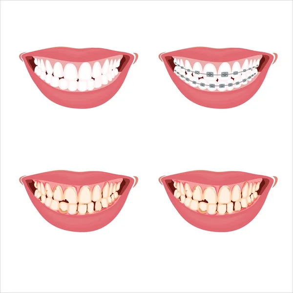 Ilustración Dental Sana Dañada Frenos Dentales Dientes Dañados Ilustración Vectorial — Vector de stock