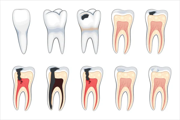 Hasarlı diş tasviri, hasarlı dişler, dişçi temsili, ağız bakımı. Diş bakımı. Diş çürüğü.