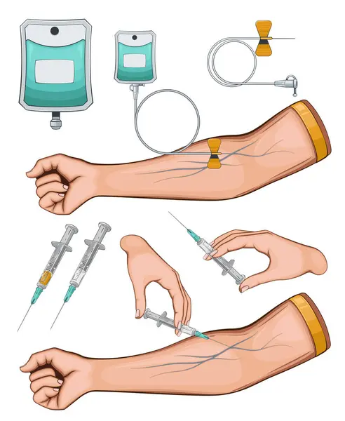 Damardan illüstrasyon. Damardan tedavi. Tıp unsurları arka planda. Tıp Eğitimi İllüstrasyonu.