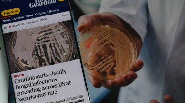 CDC raporu - Ölümcül mantar enfeksiyonu (candida aurius) endişe verici bir hızla yayılıyor. 