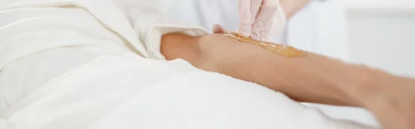 Vrouw Met Ontharing Procedure Arm Met Suiker Pasta Schoonheidssalon Close — Stockfoto
