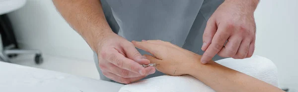 Lekarz Wykonuje Profesjonalne Leczenie Akupunktury Spa Piękności Ciele Kobiety Wysokiej — Zdjęcie stockowe