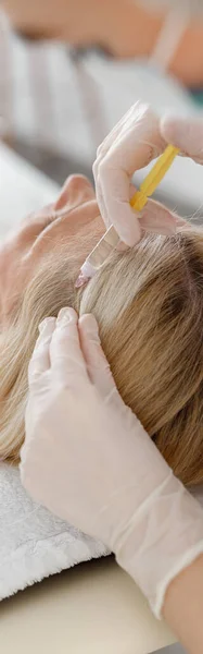 Profesjonalny Lekarz Wykonuje Wstrzyknięcie Mezoterapii Włosy Blond Pacjentki Zbliżenie — Zdjęcie stockowe
