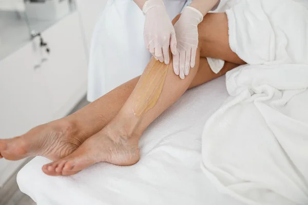 Γυναίκα Πελάτης Έχει Διαδικασία Αφαίρεσης Τρίχας Στο Πόδι Χρησιμοποιώντας Ζαχαροπλαστική — Φωτογραφία Αρχείου