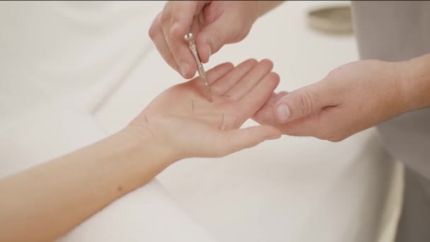 Doctors Hand Perform Acupuncture Treatment Beauty Spa Womans Body — Stock Video