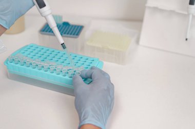 Üniformalı erkek bilim adamı tıbbi laboratuvarda biyokimyasal test analizi için mikro pipet kullanıyor. 