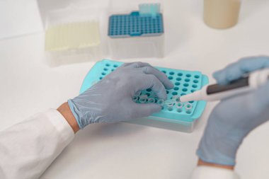 Üniformalı erkek bilim adamı tıbbi laboratuvarda biyokimyasal test analizi için mikro pipet kullanıyor. 
