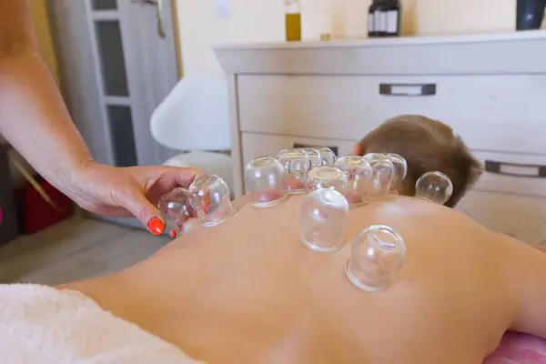 Traditional Chinese Cupping Therapy on the Back by Naturopath. Chinese Cup. Naturotherapy, massages, alternative medicine, natural medicine.