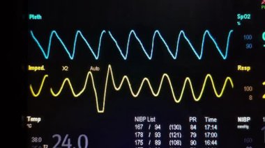 Hasta ve infüzyon pompası için hastane koğuşunda odası ve ışık geçmişi olan serum fizyolojik solüsyon serumunu kapatın. Sağlık, eğitim ve bilim içeriği için
