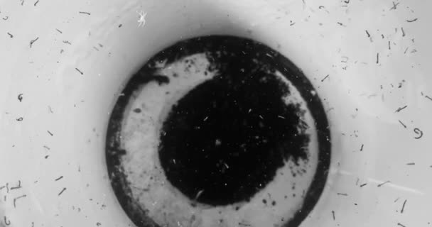 导致积水中的蠕虫长期滞留的疾病 — 图库视频影像