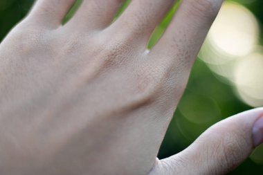 Bir insanın elinin arkasındaki deri dokusunun makro yakın plan çekimi. Dermatoloji ve cilt bakımı kavramı