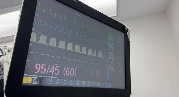 Monitor Hospitalar Simboliza Sinais Vitais Atendimento Paciente Intervenção Médica Monitoramento — Fotografia de Stock