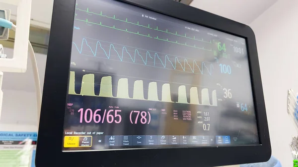 Hospital monitor symbolizes vital signs, patient care, and medical intervention wit monitoring of anesthesia, blood pressure, pulse, oxygenation, ventilation, and heart rate for patient well-being