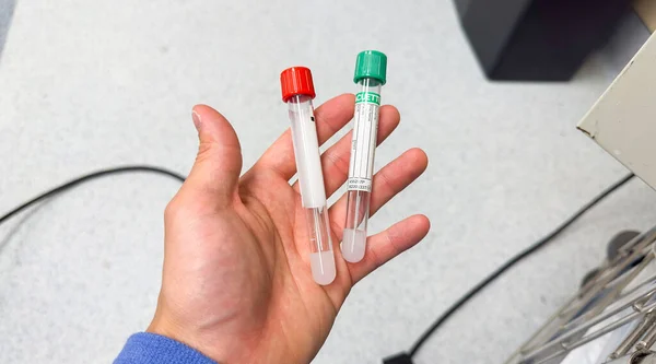Kan Tüpü Tıbbi Bakımı Teşhisi Tedaviyi Kan Testini Hastalarla Sağlık — Stok fotoğraf