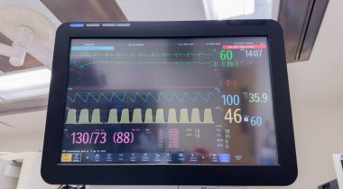 Hayati belirtileri gösteren bir hastane monitörü. Kalp atışı, nabız oksijeni, ateşi, kan basıncı. Sağlık izleme, yaşam desteği ve tıbbi bakımı sembolize eder.