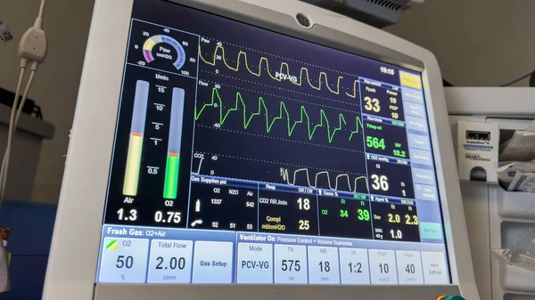 Hayati Belirtileri Gösteren Bir Hastane Monitörü Kalp Atışı Nabız Oksijeni — Stok fotoğraf