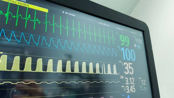 Monitor Szpitalny Wykazujący Oznaki Życiowe Tętno Ciśnienie Krwi Pulsoksymetria Temperatura — Zdjęcie stockowe