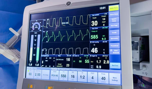 手術室の患者のモニターのための医療機器のアップ モニターは手術室の心臓モニターで — ストック写真