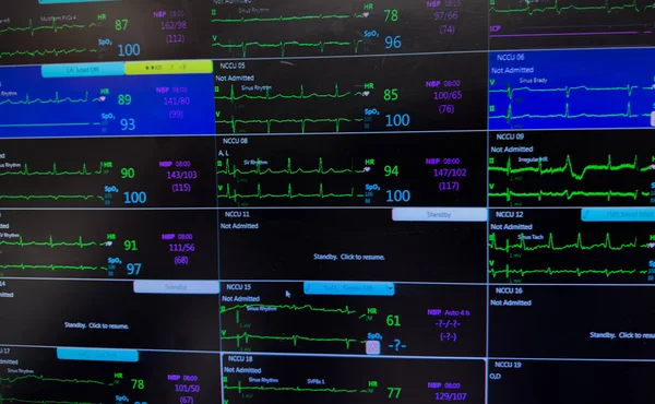 heart rate of the monitor monitor. monitor of heart rate in the monitor. monitor with heart monitor screen monitor. monitor monitor monitor with cardiogram