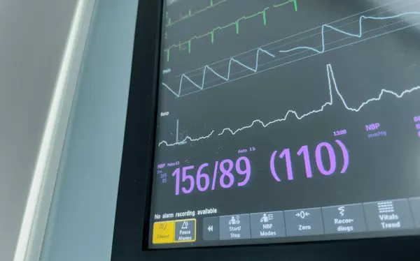 close - up of a monitor with a monitor screen. the monitor with a monitor with the cardiogram. monitor display in a heart rate.