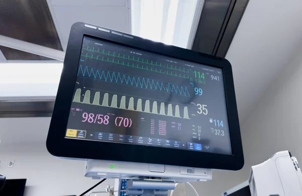 monitor of a medical monitor with a heart rate monitor in the hospital.