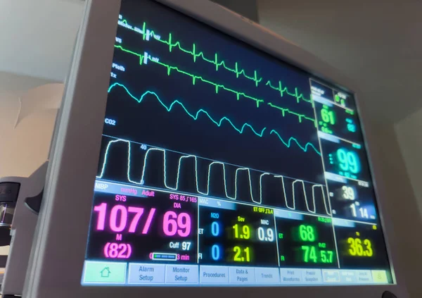 close up of a heart monitor in a room