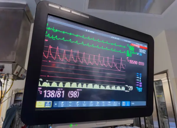 close up view at the monitor with the monitor of heart rate
