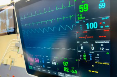 Kardiyogram monitör ekranı, monitör monitörü, kalp atış hızı monitörü ekranı