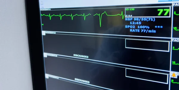 monitor monitor with a cardiogram monitor screen. monitor with a heart rate monitor. monitor screen of monitor monitor with a monitor display. monitor monitor