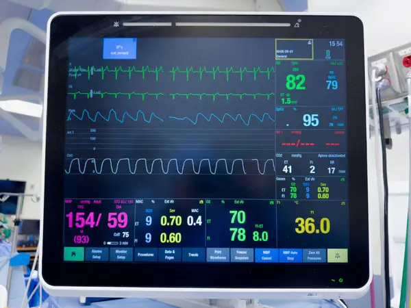 monitor with a medical monitor for a heart rate