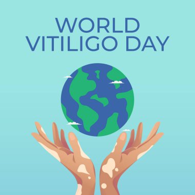 Dünya Vitiligo Günü tasarımı kutlama için iyi bir şablon. Vitiligo vektör çizimi. Vitiligo görüntüsü. 10. vektör. Düz dizayn.