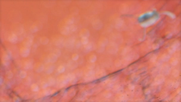 艺术家概念绘制 显微图像 医用纳米机器人注射抗生素在人体组织中的应用 — 图库视频影像