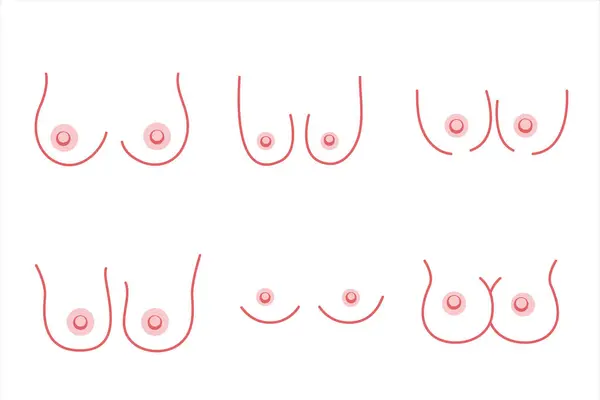 一组女性乳房 不同尺寸的乳房 乳腺癌 在透明的背景上的行样式 Doodle矢量说明 — 图库矢量图片