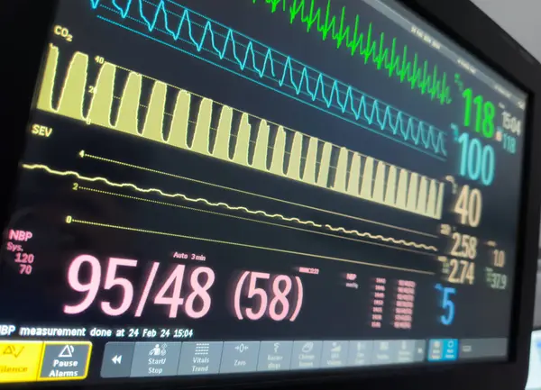 kardiyogram için dijital monitör