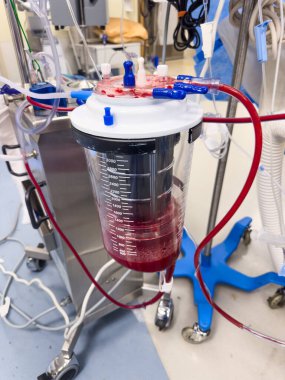 Hastanede kan basıncı makine