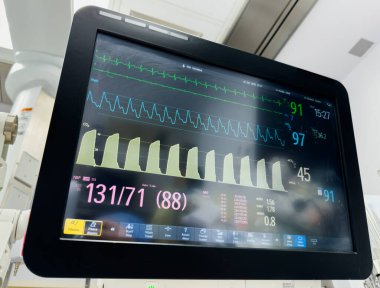 Hastane odasında ameliyat monitörüyle kalp atış hızı monitörü.