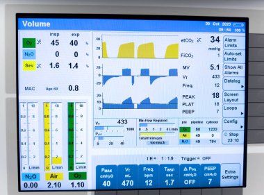 Yüksek voltajlı bir elektrik santralinin izlenmesi ve izlenmesi için modern izleme